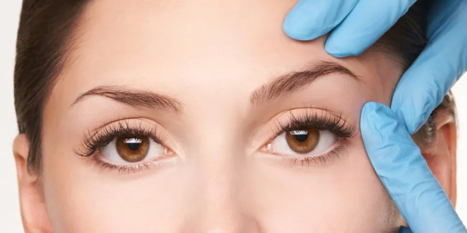 Blepharoplasty Atas dan Bawah, Epicanthoplasty